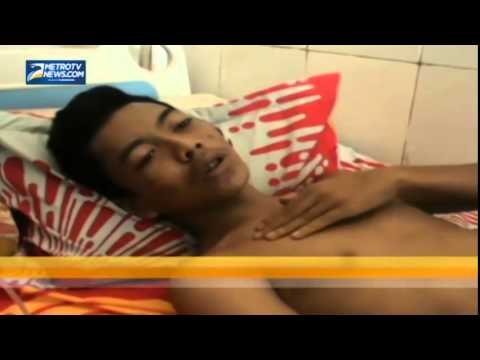 Dianiaya Guru, Seorang Murid Alami Patah Tulang Rusuk