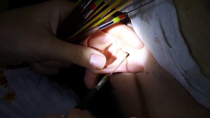 통영출장마사지【후불1ØØ%ョ】Ø1Øb2671s8135【카톡KC456】##J통영전지역출장안마'통영출장맛사지'샵통영출장마사지'콜걸'출장안마'20대여대생！æđð출장콜걸출장콜걸