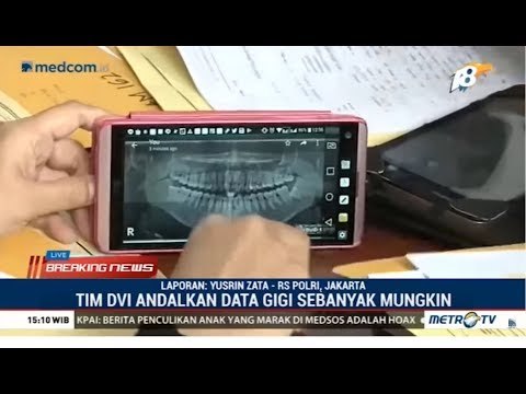 Tim DVI Terima Data Gigi, Rambut dan DNA untuk Identifikasi Korban Lion Air