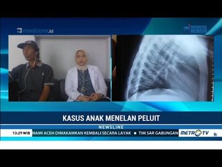 Begini Kronologi Peluit Bisa Bersarang di Paru-paru Asep