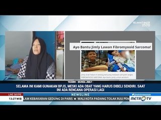 Perjuangan Jimly Melawan Kanker Langka