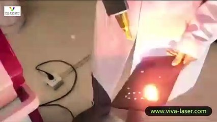 Laser tattoo removal machine energy testing