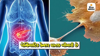 શું છે પેન્ક્રિયાટિક કેન્સર કે જેની સામેની લડતમાં પર્રિકર હારી ગયા