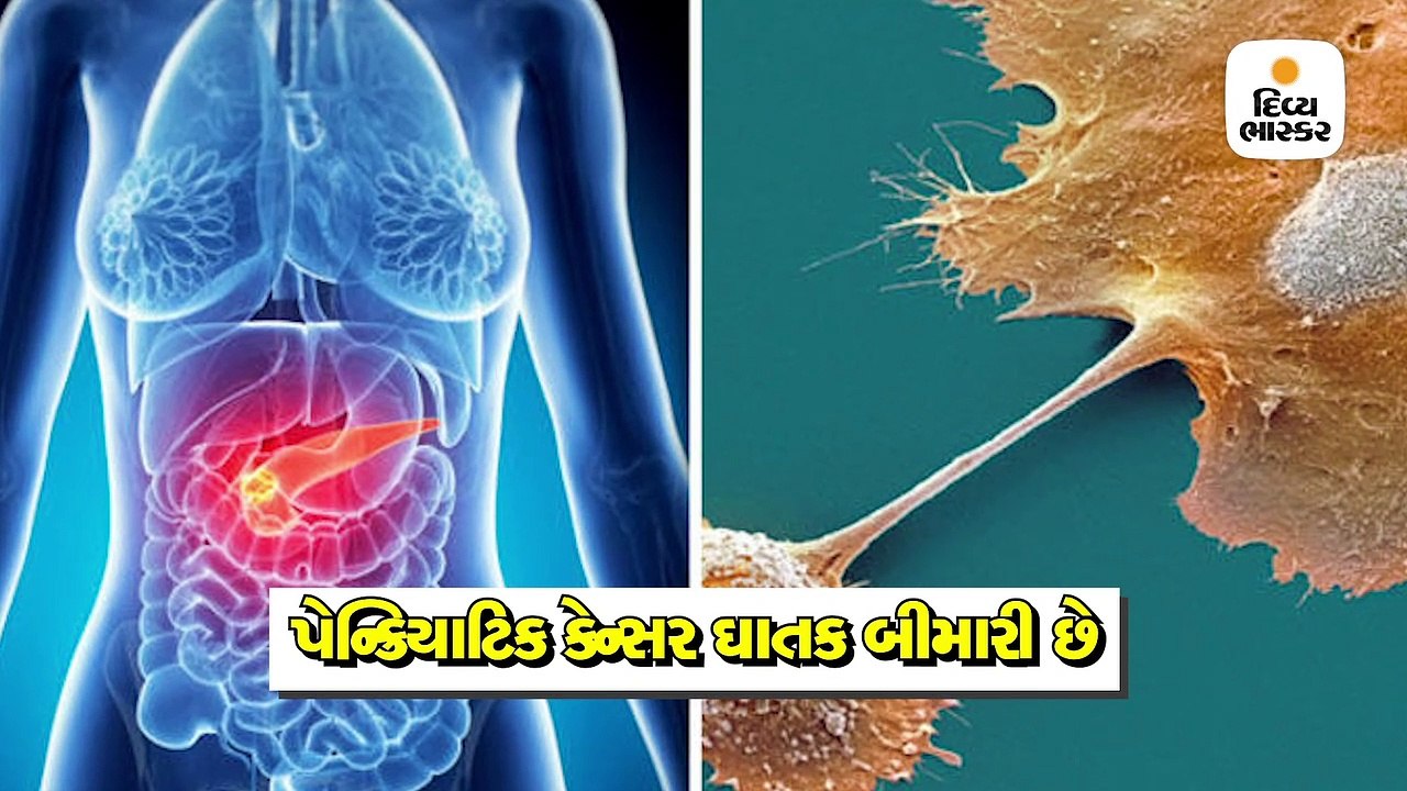 શું છે પેન્ક્રિયાટિક કેન્સર કે જેની સામેની લડતમાં પર્રિકર હારી ગયા