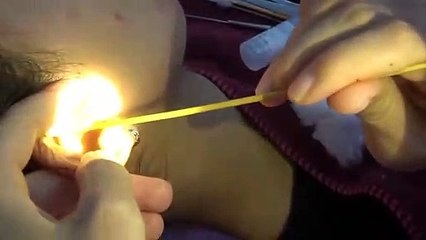 포천출장마사지 -후불1ØØ%ョØ7Ø_7575_ØØ62【카톡LJ69】#Y#포천전지역출장안마'포천출장맛사지'샵포천출장마사지'콜걸'출장안마'20대여대생！ЭЮЯ출장콜걸'출장마사지'출장안마후기'