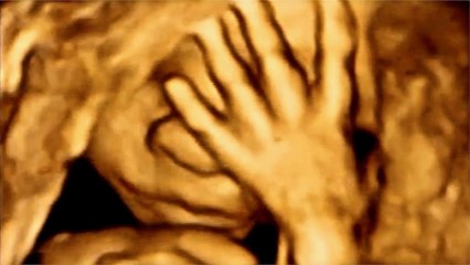 Incredible 3D & 4D Scan of what unborn babies do in the womb