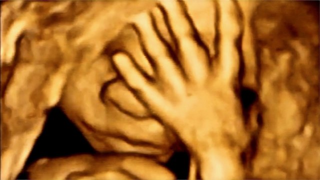 Incredible 3D & 4D Scan of what unborn babies do in the womb