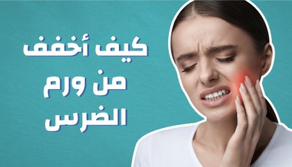 كيف أخفف من ورم الضرس؟