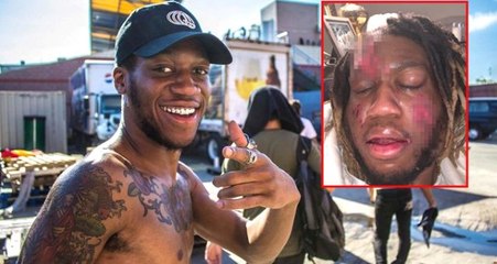 ABD'li Rapçi OG Maco, Et Yiyen Bakteri Kaptı