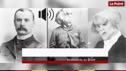 11 avril 1890 : le jour où l'homme éléphant est retrouvé la nuque brisée