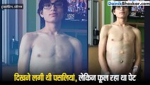 15 साल के लड़के के पेट से निकला 11 किलो का ट्यूमर
