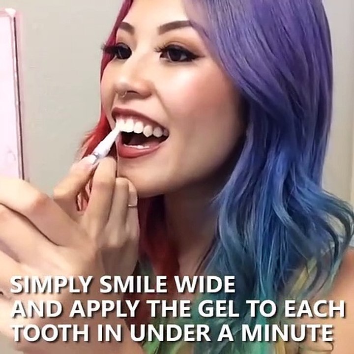 Dazzling Teeth Whitening