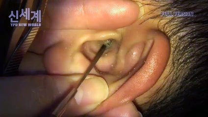 영천출장마사지 -후불1ØØ%ョØ7Ø_73Ø1_9649【카톡CNF698】#C#영천전지역출장안마'영천출장맛사지'샵영천출장마사지'콜걸'출장안마'20대여대생！ュユョ'출장마사지'출장안마후기'출장콜걸