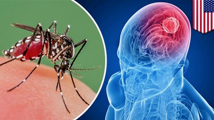 Zika Virus - A New Cure For Cancer