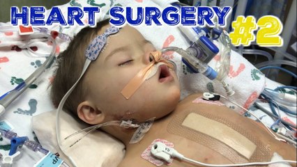 Baby with Down Syndrome has 2nd Heart Surgery in 5 Months