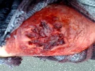 Bras morsure zombie objectif terror 6 maquillage par david