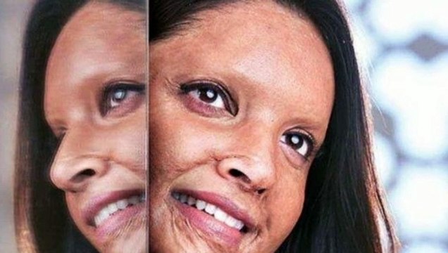 Chhapaak: Deepika Padukone’s First Look as Acid Attack Survivor Laxmi Agarwal is Out; Meghna Gulzar