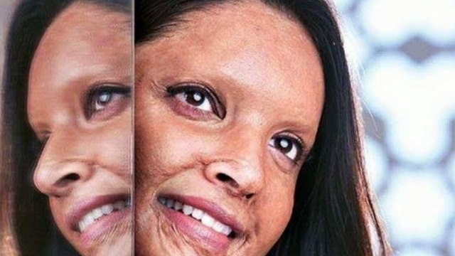 Chhapaak Movie First Look Teaser Review;छपाक ; Deepika Padukone, Meghna Gulzar