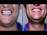 How to get pearly white smile