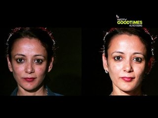 How to treat skin pigmentation