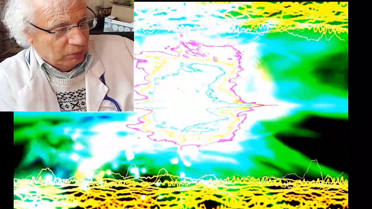 437 ARYTHMIE CARDIAQUES  EXTRASYSTOLES PALPITAITON ANGOISSE PANIQUE STRESS