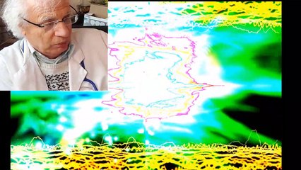 437 ARYTHMIE CARDIAQUES  EXTRASYSTOLES PALPITAITON ANGOISSE PANIQUE STRESS