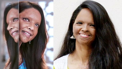 Laxmi Agarwal: The Real Inspiration Behind Deepika Padukone's Character In Chhapaak