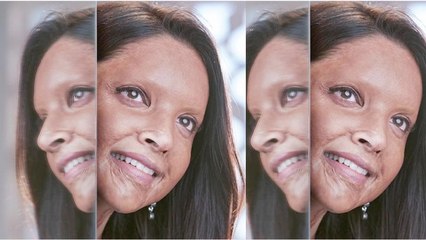 Chhapaak: Find details of Deepika Padukone's Prosthetics Make Up | FilmiBeat