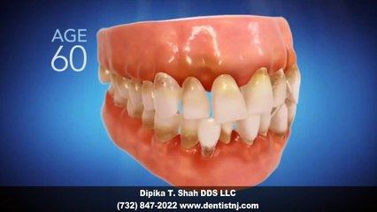 Invisalign Dentist Holmdel NJ