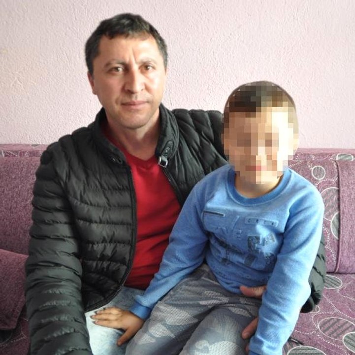 Kreşte Otizmli 4 Yaşındaki Çocuğa İşkence İddiası! Baba, Oğlunun Bacaklarını Görünce Şoke Oldu