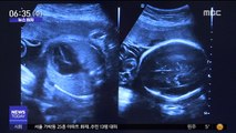 [뉴스터치] 서울시 출생축하용품 51가지로 확대…온라인 신청