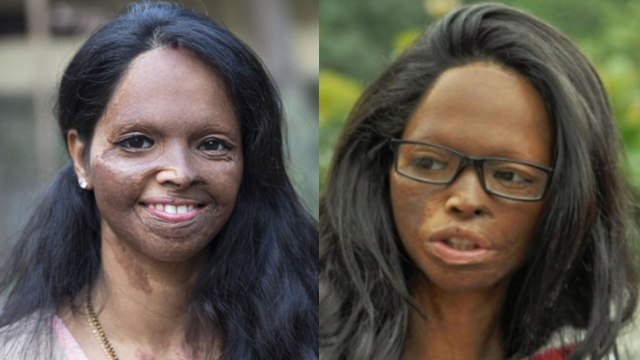 Deepika Padukone plays role of Laxmi Aggarwal in Chhapaak; Know the REAL STORY | FilmiBeat