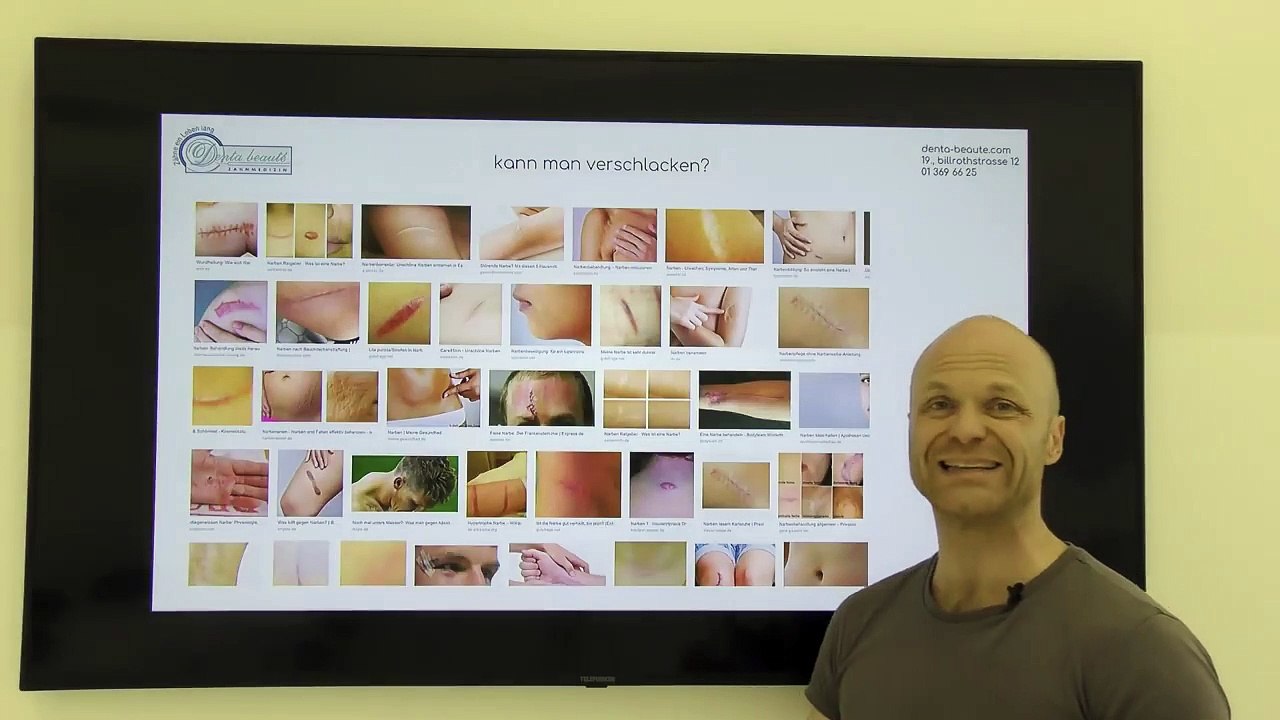 Entschlacken - Entgiften - Detox geht das überhaupt?