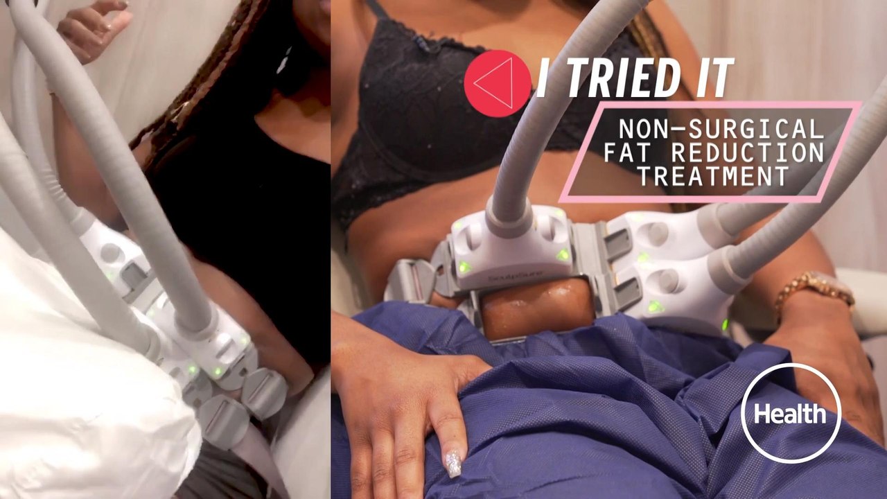 I Tried It-Sculpsure