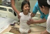 Una niña peruana de ocho años sin piernas ni brazos
