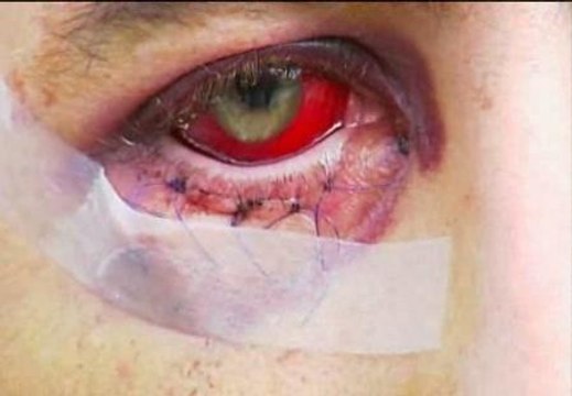 Denuncian una brutal paliza de varios porteros de una discoteca de Granada