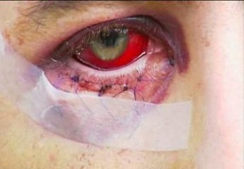 Denuncian una brutal paliza de varios porteros de una discoteca de Granada