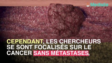 Cancer de la prostate : un manque de testostérone le favoriserait