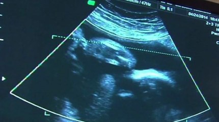 Georgia Senator Makes Emotional Plea For A Woman’s Right To Choose