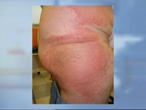 Un sofá fabricado en China causa fuertes alergias a su comprador