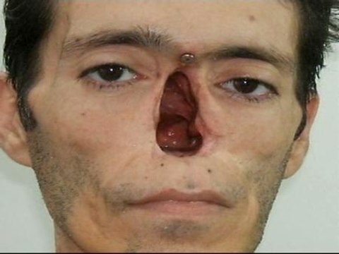 Prótesis de silicona y cera para recuperar rostros y dedos