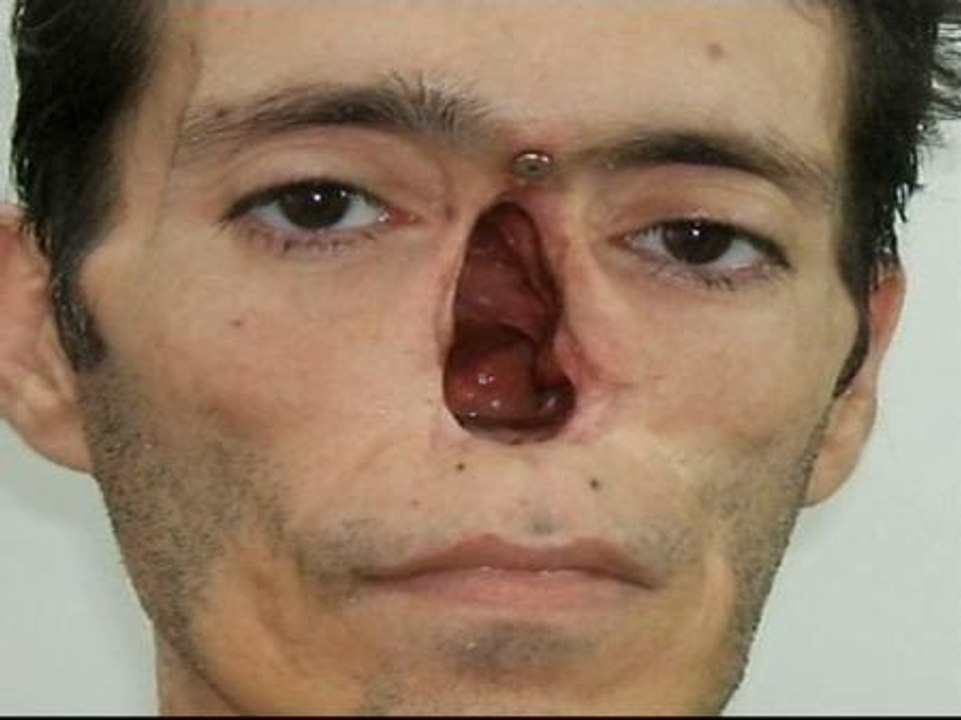 Prótesis de silicona y cera para recuperar rostros y dedos