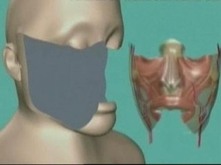 Realizado en EEUU el mayor transplante de cara