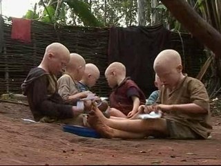 La maldición de los albinos