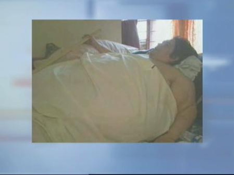 Muere uno de los hombres más obesos del mundo