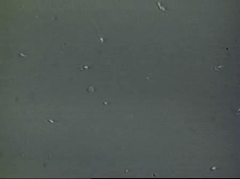 Más de la mitad de los jóvenes españoles tiene un semen de mala calidad