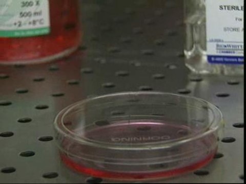 España aportará 10,2 millones de euros a la ONU para combatir el SIDA