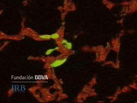 Las claves de la metástasis