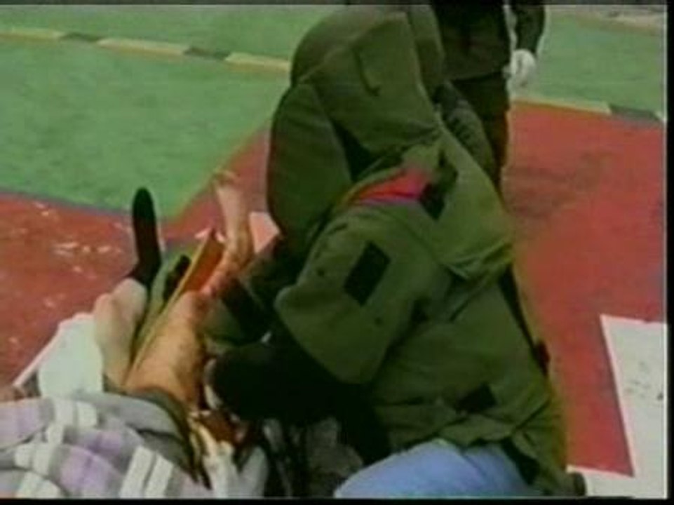 Extraen una granada intacta de la pierna de un soldado en Colombia