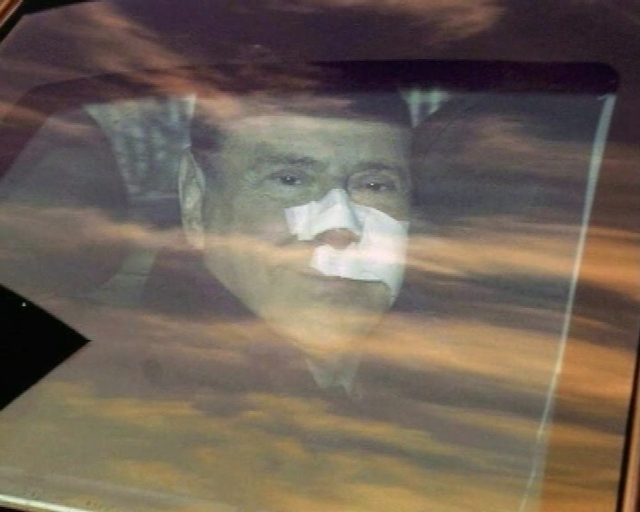 Silvio Berlusconi sale del hospital